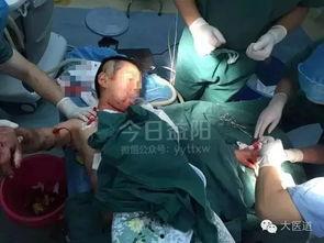 吃瓜砍十几刀视频